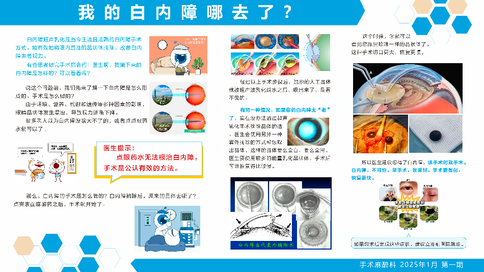 我的白内障哪去了？.jpg