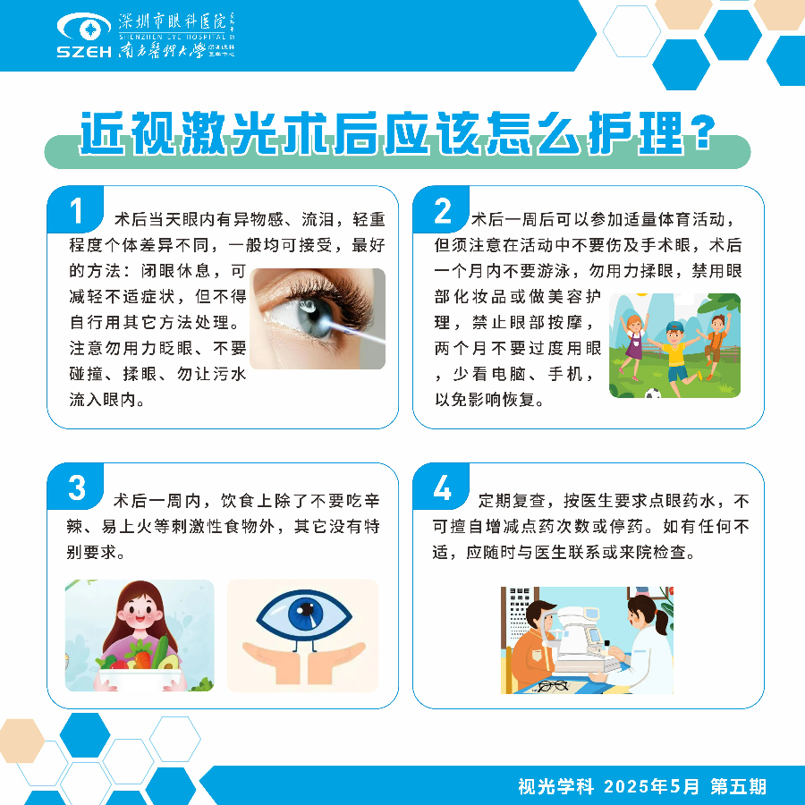 近视激光尤后应该怎么护理.jpg