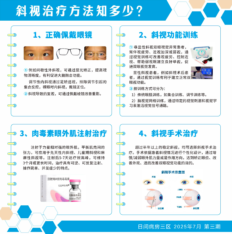 斜视治疗方法知多少.jpg