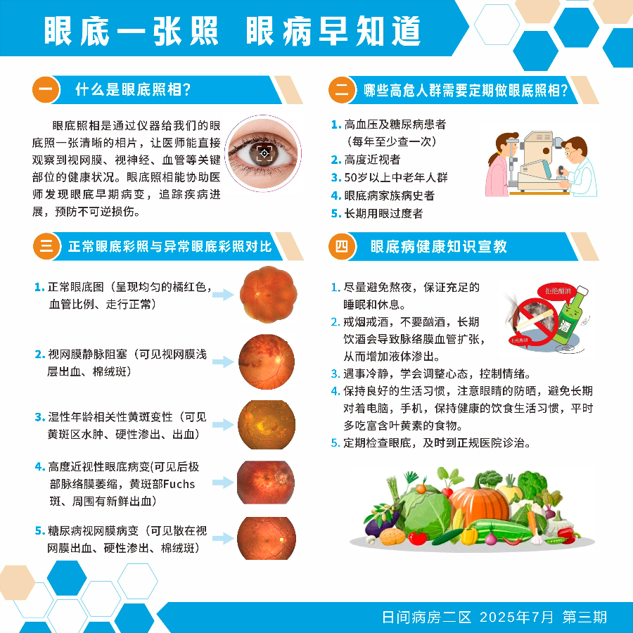 眼底一张照 眼病早知道.jpg