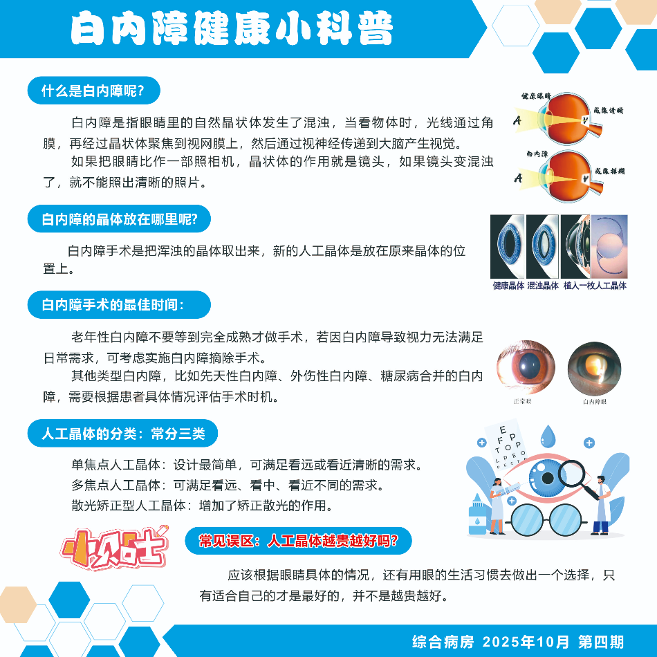 白内障健康小科普（二）.jpg