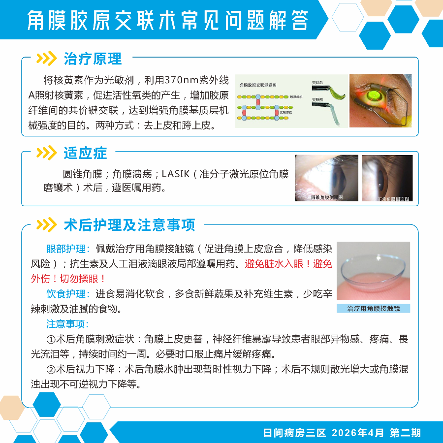 角膜胶原交联术常见问题解答.jpg