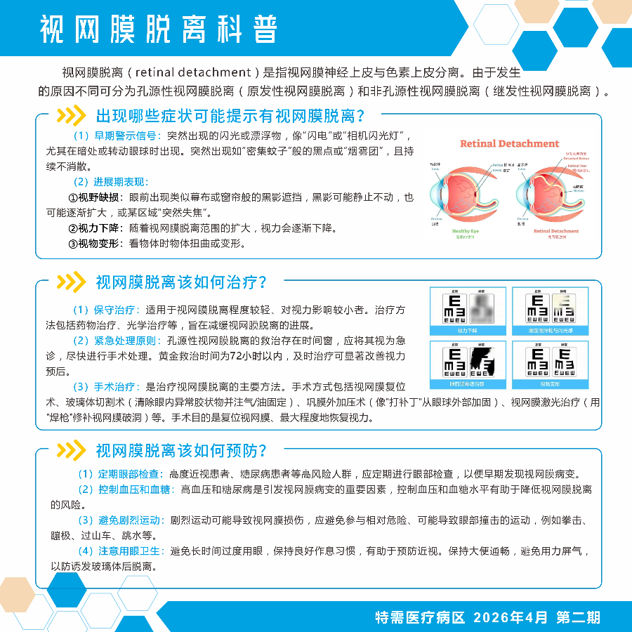 视网膜脱离科普.jpg